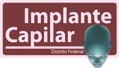 Implante Capilar Goiânia-GO - Transplante de Cabelo, FUE Goiânia-GO
